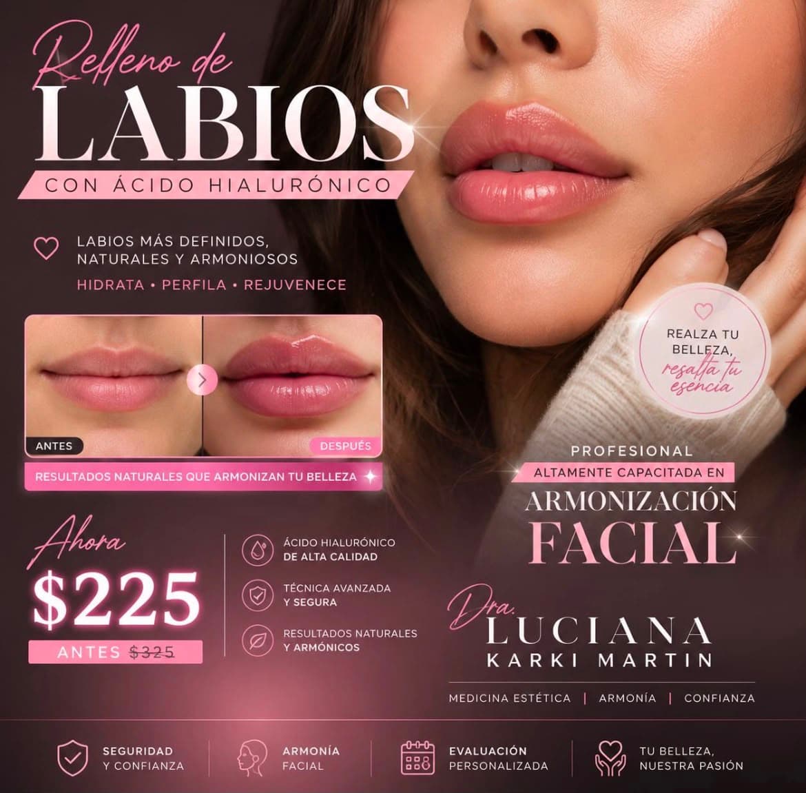 Promoci?n de relleno de labios con ?cido hialur?nico